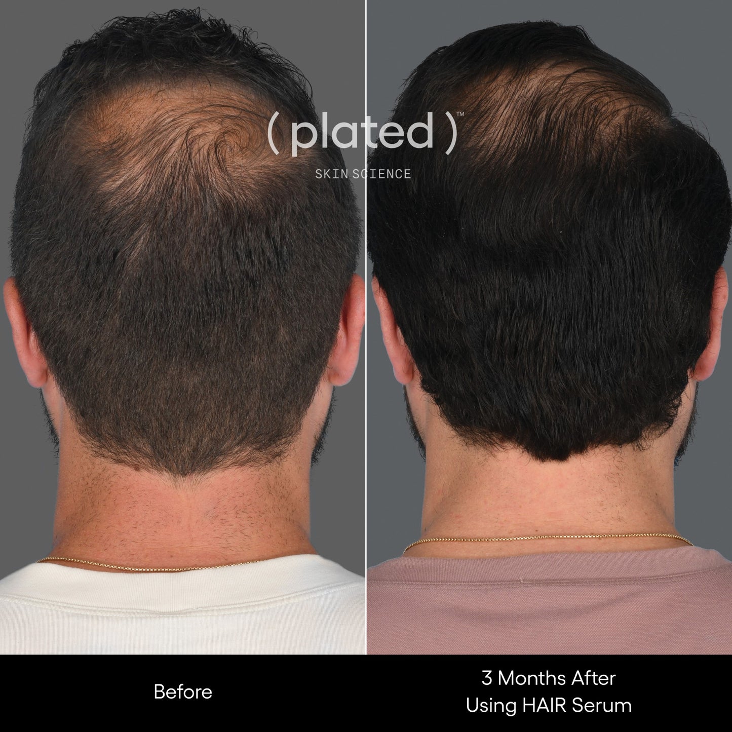 Plated Hair Serum